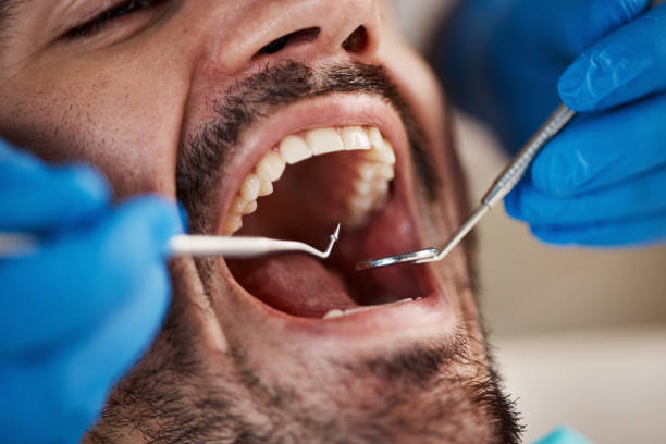 Best Tooth Infection Emergency Dentist  in Cordry Sweetwater Lakes, IN