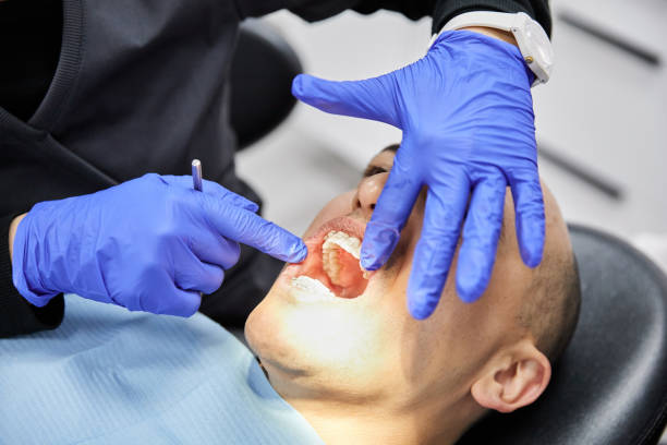 Best Urgent Tooth Repair  in Cordry Sweetwater Lakes, IN